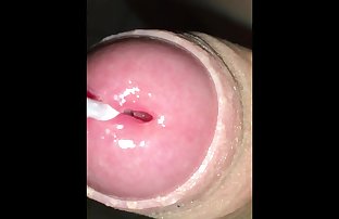 Painful cock insertions and foreskin play on young teen cock